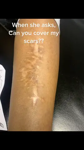 Scar coverup, #scars #legtattoos #southafricantattooartist #zimtattoo #satiktok🇿🇦 #zimtiktokers🇿🇼🇿🇼🇿🇼  #viral #content #contentcreator