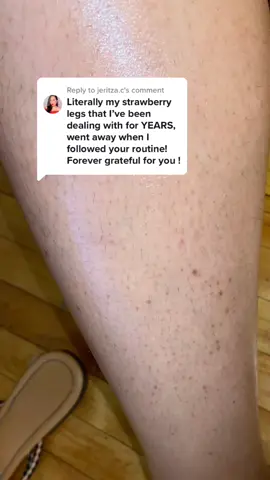 Replying to @jeritza.c IM SO HAPPY TO READ YOU GUYS 🥺❤️ #strawberrylegs#skincare#ingrownhair