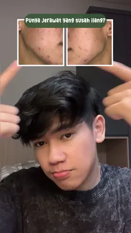 [repost] Seriusan weh kudu cobaa.. @Men's Reaction Official #mensreaction #pejuangjerawat 