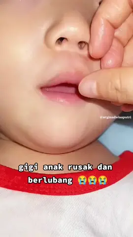 rekomendasi sikat gigi anak #anak #anakpintar #mainananak