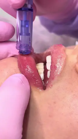 Lábios ressecados nunca mais!! Conheça Pump Lips (hydragloss) ❤️  #hydragloss #pumplips💄 