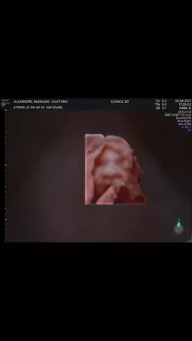 1 aninho da nossa princesa linda!❤️❤️❤️❤️❤️ Obrigada por ter nos escolhido anjo lindo!😍😍😍😍 18 agosto!🥳🥳🥳 #amordasnossasvidas #amormaior #1aninho #princesalinda #teamamos #familia #amordamamaeedopapai #fyp #fy #aniversario #Isabellefaz1 #viral