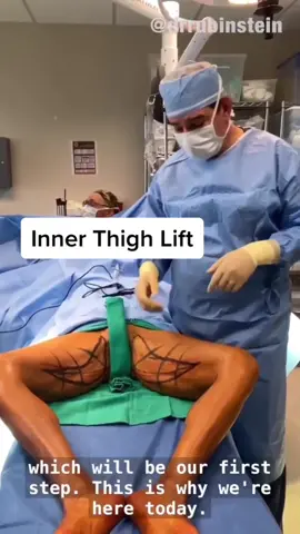 Inner Thigh Lift #thigh #lift #operation #doctor #life #patient #viraltiktok