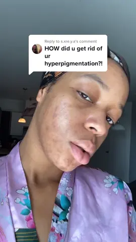 Replying to @s.xre.y.a MAGIC IN A BOTTLE 🔥🔥🔥🔥 #vitamincserum#acne#darkspots