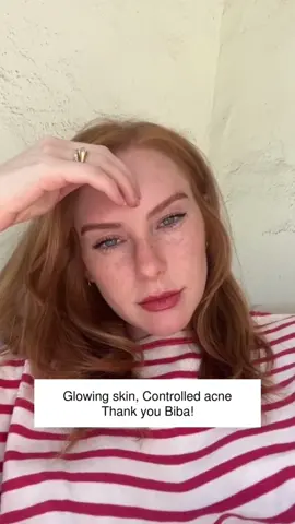 A simple solution #bibalosangeles #biba #skincare #skincareroutine #skincaretips #glowingskin #SkinCare101 