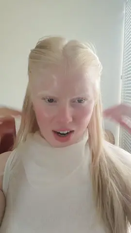 #albino #brasil #fyp #viral #albina