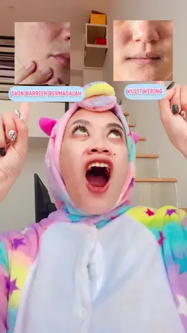 CINTA BANGET!! Cuma 30Ribuan udah bisa atasin berbagai masalah🥺♥️ #BeautyTok #gayaditiktok #theoriginote #hydratingtoner #eksfoliasitoner @The Originote Offical