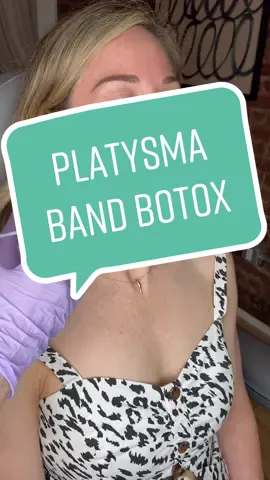 10 units of Botox injected to each platysma band to relax her prominent neck muscles. #botoxinjection #botox #dysport #dysportinjections #platysmalbands #platysma #neckgoals