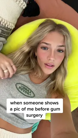 😐