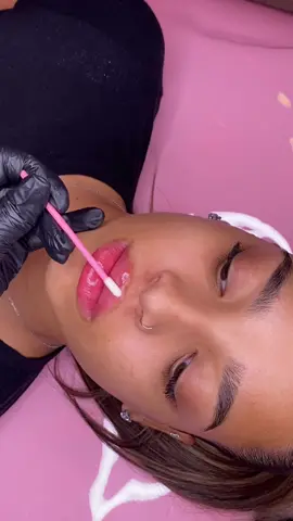 SIGNATURE DOLL LIPS FOR THIS BABE 👄💸💘 #lipfiller #lipfillercheck #lipfillergonewrong #russiantechnique #russianlips #lipfillerprank #lipfillerlondon #lipfillerbirmingham #beforeandafter 