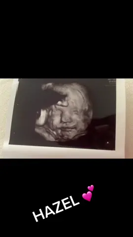 Miss Hazel we are so ready to meet you already! #thirdtrimester #letrozolebaby #fyp 