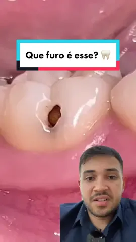 #react #reagindo #dentista #dicasdasaude #health #saude #curiosidades #fy #fypシ #fypage
