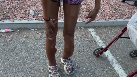 Lulu is homeless & addicted to smoking fentanyl pills. She’s literally walking on a broken leg but refuses to go to hospital. Watch the full interview at Lost in Phoenix on YouTube 