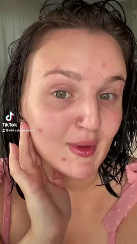 HOW TO PERFECTLY COVER ACNE USING THE STICKY METHOD 😳👌🏻 #makeup #beauty #acne #acnecoverage