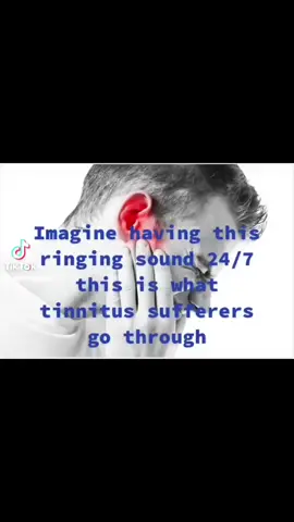 a short video of the tinnitus sound I face daily #hiddendisabilities #nhs #fyp #tinnitus #educational #hearingloss #hearingaids 