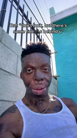 Don’t play with me lol lemme turn my head fast 😳 #fyp #foryou #viral