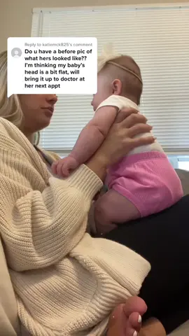 Replying to @katiemck825 💓💓💓 #helmetbaby #MomsofTikTok 