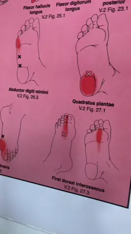 r.i.p. foot pain #chiropractor 