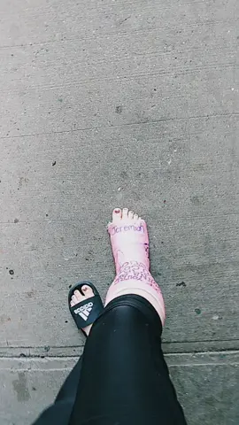 walking with my cast last day over it! 