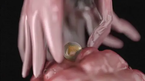 ovulation #estrogen #hormone #cervical #folecule #