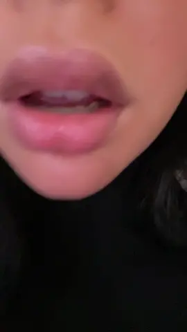 M’y cat got scared #fyp 