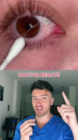 eye boogers