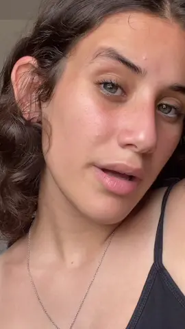 איך נפטרים מהשאדובן? והחצקון במצח מה איתו?#תוציאואותימשאדובאן