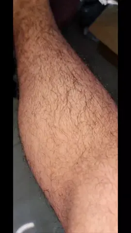 our pansly Hair Removal spray in action. only 8 minutes, no pain or burns, #trini_tiktoks #trending #hairremoval