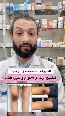 #تفتيح_الركب_الاكواع  #جوزة_القدم #معلومة_طبية #دكتور_حسام #د_حسام_المحجوب 