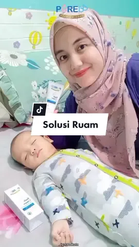 sedia Pure BB Rash Cream di rumah ya! Karena Pure BB Premium Care for your baby  #PureBBIndonesia #PureBBRashCream #SolusiRuam #momlife 