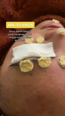Apa itu sinus..#ditaja🇲🇾 #resdung #resdungkronik #resdungtreatment #resdungteruk #resdungsinus #resdungtanpaasap #wangsamaju #srirampai #setapak #kl #kualalumpur 