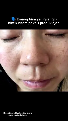 Mantul banget! Bintik hitam memudar dalam 14 hari 😍#caramenghilangkanflek  #leikaskincare #leika #skincareleika #ViralDiTiktok #bintikhitam #creampenghilangflekhitam #bintikhitamwajah #daycream #penghilangflek #creamBPOM #amanbumilbusui #skincarecowok #skincareflekhitam #flekhitam #skincare #skincareroutine #skincareflek #bintikhitamhilangcepat  #creamhalal #creamglowing #wajahcerahseketika #wajahkusam #fleksusahhilang #susahputih #mukasusahputih #kerutandiwajah #masalahwajah #solusiwajah #solusiwajahflekhitam #solusimuka #mukaberminyak #mukakusam #mukaflekhitam #mukabintikhitam #mukabelang #caramukaglowing #caramukajadibersih #caramukacerah #caramukatidakkusam #mukakusam #bebasflek #wajahbersih #caramenghilangkanflek #flekmenahun #flekmembandel #creamflekhitam #paketflek  #plekhitamdiwajah #bintikhitamwajah #penghilangbintikhitam