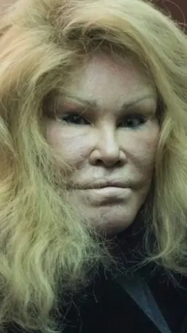 she suffered so much :/ #fy #jocelynwildenstein #catwoman #plasticsurgery #viral 