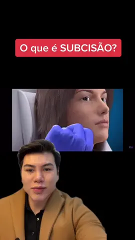 Explicando um pouco mais sobre SUBCISÃO para cicatrizes de acne ou outras cicatrizes atróficas! #medicinaestetica #harmonizacaofacial #medico #cicatrizes #peeling #cicatrizdeacne #acne #manchas 