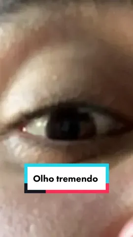 Seu olho já tremeu sozinho? #saude #dicasdasaude #dicasdesaude #oftalmologia #olhos #dançadosolhos #fy #foryou 