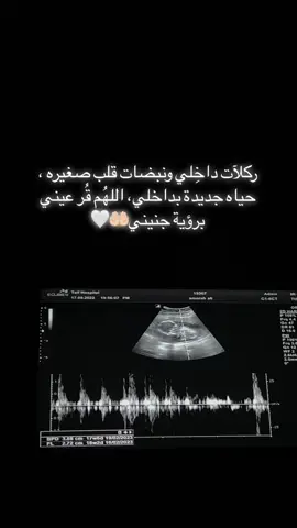 عرفتو جنس البيبي؟ومتى؟ 😍#ماشاءالله #حوامل #جنيني #بيبي #سونار #بيبي_جديد #explore #اكسبلور ##fypシ #اكسبلورر #طلعوه #4u 