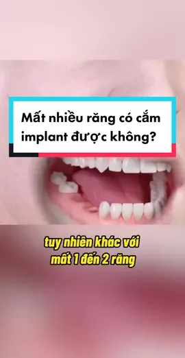 Mất nhiều răng có cắm implant được không? #LearnOnTikTok #education #niengrang #sharing #cyberad #tips #nhakhoaledong #lemoney 