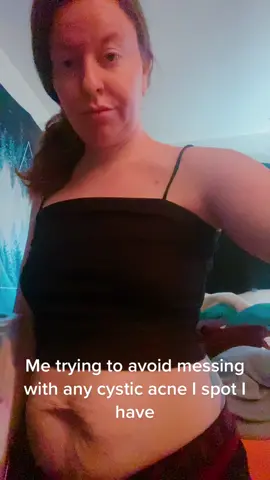 Sorry if im not to active, just taking a break#imnotgonnadoit #cysticacne 