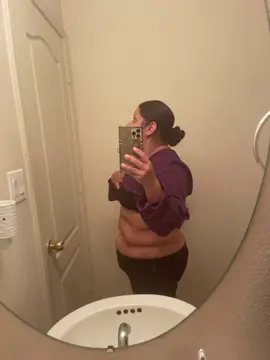 #motivation #weightloss #tummytuck 