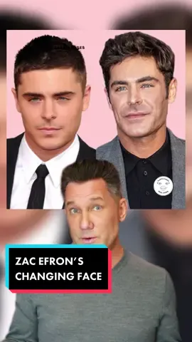 #ZacEfron’s face has changed again, here’s my evaluation 🥼 #PlasticSurgery #ZacEfronEdit #MensPlasticSurgery #CelebrityPlasticSurgery #CelebrityPlasticSurgeon #JawlineContour #ChinImplant #ChinImplantBeforeAndAfter #Zefron #LipFiller #CelebSurgery #BotchedPlasticSurgery #CosmeticSurgeryTikTok #CelebrityFace 