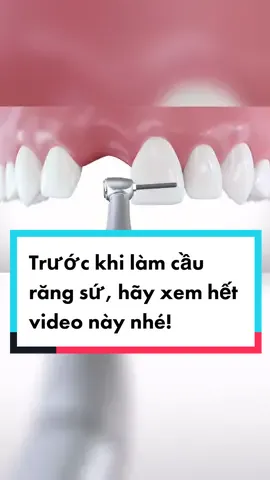 Trước khi làm cầu răng sứ, hãy xem hết video này nhé! #LearnOnTikTok #education #niengrang #sharing #cyberad #tips #nhakhoaledong #lemoney 