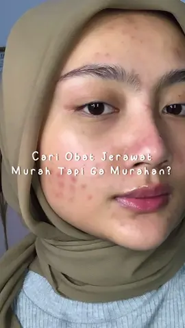 Yaudah deh mau sungkem sama Brand ini🥵 @The Originote Offical #AcneSpot #TheOriginote #AcneFighter 