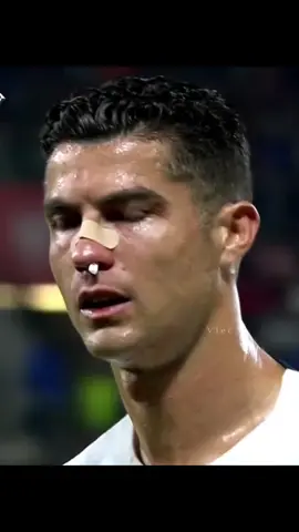 It’s just so sad to see my goat Ronaldo bleeding n people making fun at him. #ronaldo #cristianoronaldo #cristiano #portugal #fyp #foryou #foryoupage #رونالدو #كريستيانو 