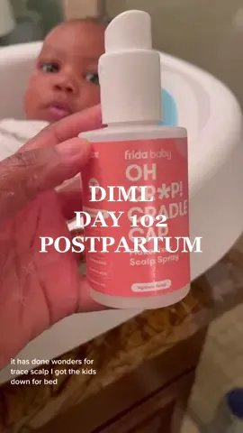 Day in the life living in ALASKA: I dont know what happeend to my eye! #ditlofamom #momlife #alaska #MomsofTikTok #sahm #BlackTikTok #errands #comewithme #minivlog #blacktiktok #momcontent #momtok #mommyhacks #babiesoftiktok #productivity #familyvlog #postpartum @4moms #postpartumjourney #pregnancytiktok @Fridababy 