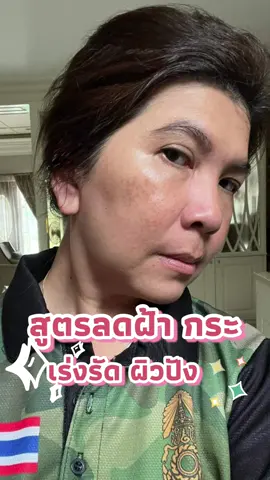 สูตรแก้ฝ้า กระ จุดด่างดำ ใครมีปัญหาด้านนี้ต้องลอง ‼️‼️ #ชายนิ่ง #อาโมมิกซ์ #อาโมมิกซ์คอลลาเจน #ลดฝ้ากระจุดด่างดํา #ลดฝ้ากระ #ผิวดีบอกต่อ 