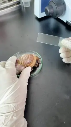 Chất Nhờn ốc sên rất tốt...nhưng mà khoan khoan đã...#kinhhienvi #duoikinhhienvi #vikhuan #xuhuong