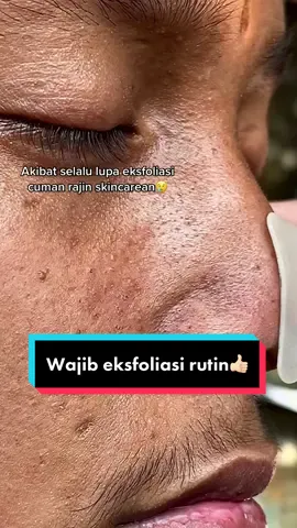 Kunci kulit rusak biar membaik adalah eksfoliasi #cleorabeauty 