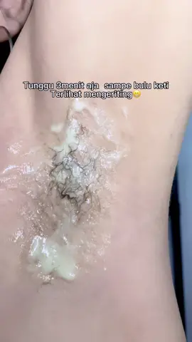 Tanpa sakit, cukup 3mnt aja 😍❤️@Skinuvia Official #xcyzba #skinuviahairremoval #perontokbuluketiak #fypシ #fyp 