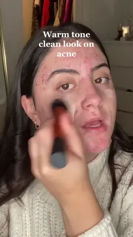 Replying to @anna99936 love this warm tone clean look! Just remember that you are not defined by what your skin looks like 🥰❤️ #skincare #acneskincareroutine #acneproneskin #acnepositivity #skincareroutine #acnemakeup #acnecommunity #makeup #grwmmakeup #cleanlook #skinpositivity 