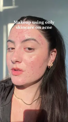 Using skincare as my makeup works so great for my acne skin ❤️🥰 the @vichylaboratoires  Mineral 89 booster and Mineral tinted sunscreen are two of my faves ❤️ #vichypartner #vichycanada AD #makeuptutorial #cleangirlmakeup #skincaremakeup #glowyskin #acnecoverage #acnemakeup #morningskincare #skincareroutine #grwmmakeup #mineral89 